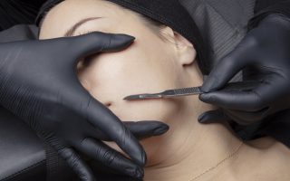 Dermaplaning – Everything You Need to Know