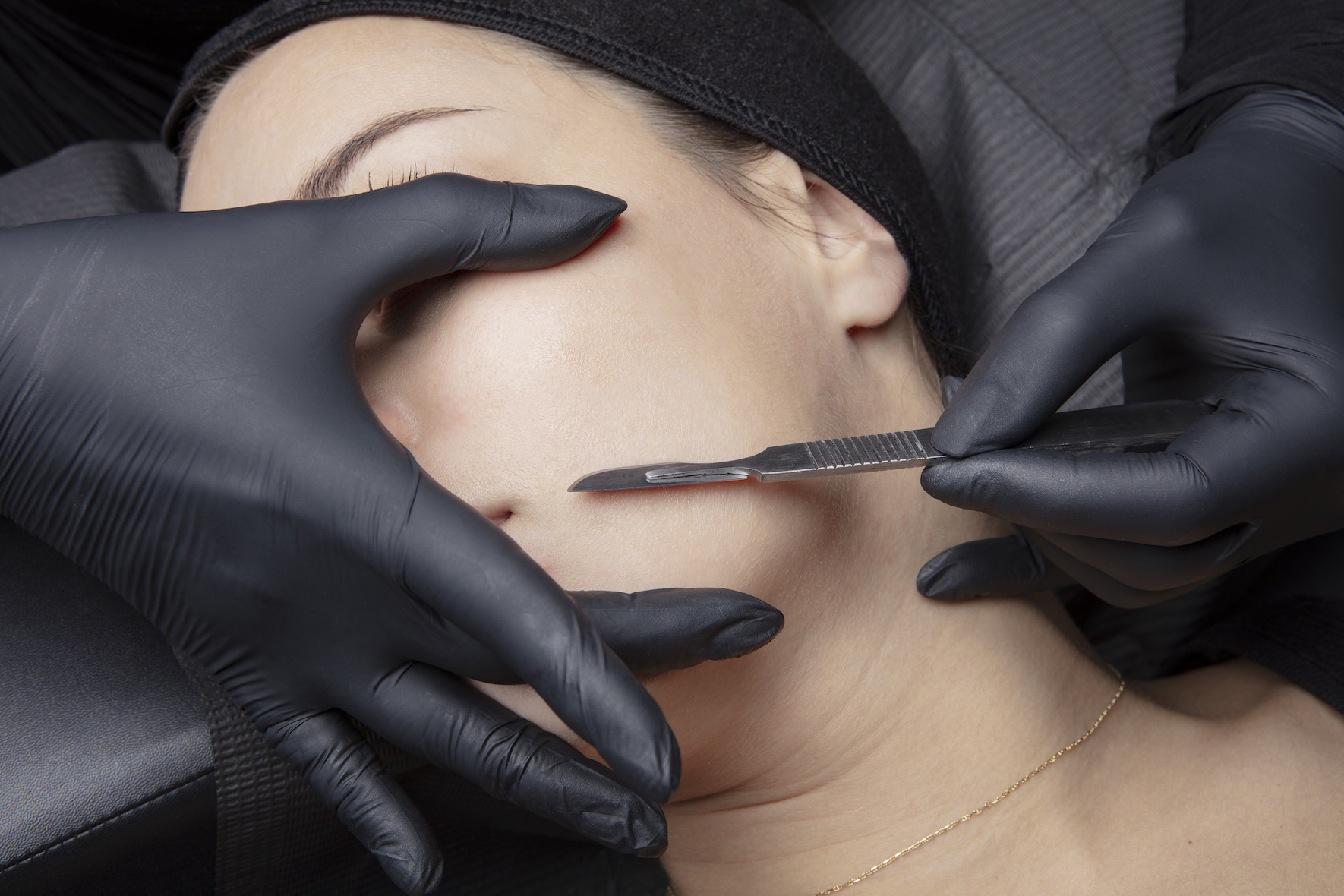 Dermaplaning – Everything You Need to Know