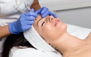 Microdermabrasion – Everything You Need to Know