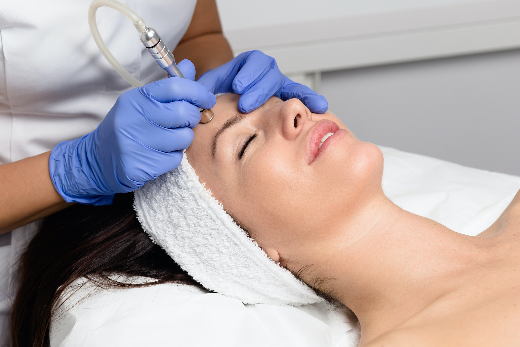 Microdermabrasion – Everything You Need to Know